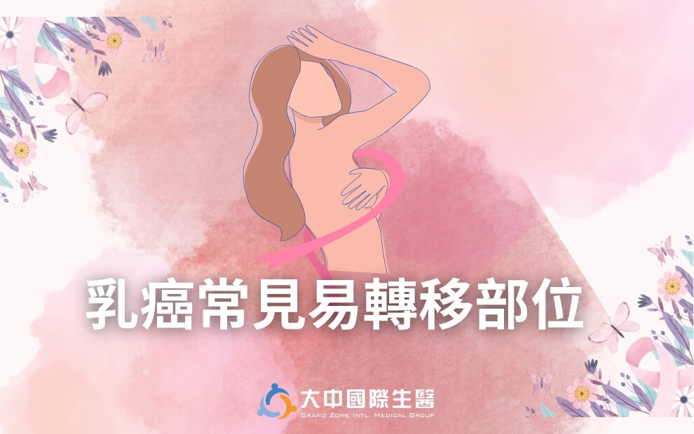 乳癌常見轉移部位|了解風險與治療選項