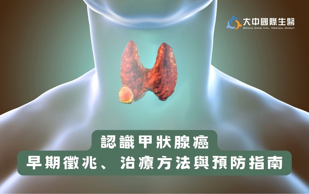認識甲狀腺癌：早期徵兆、治療方法與預防指南