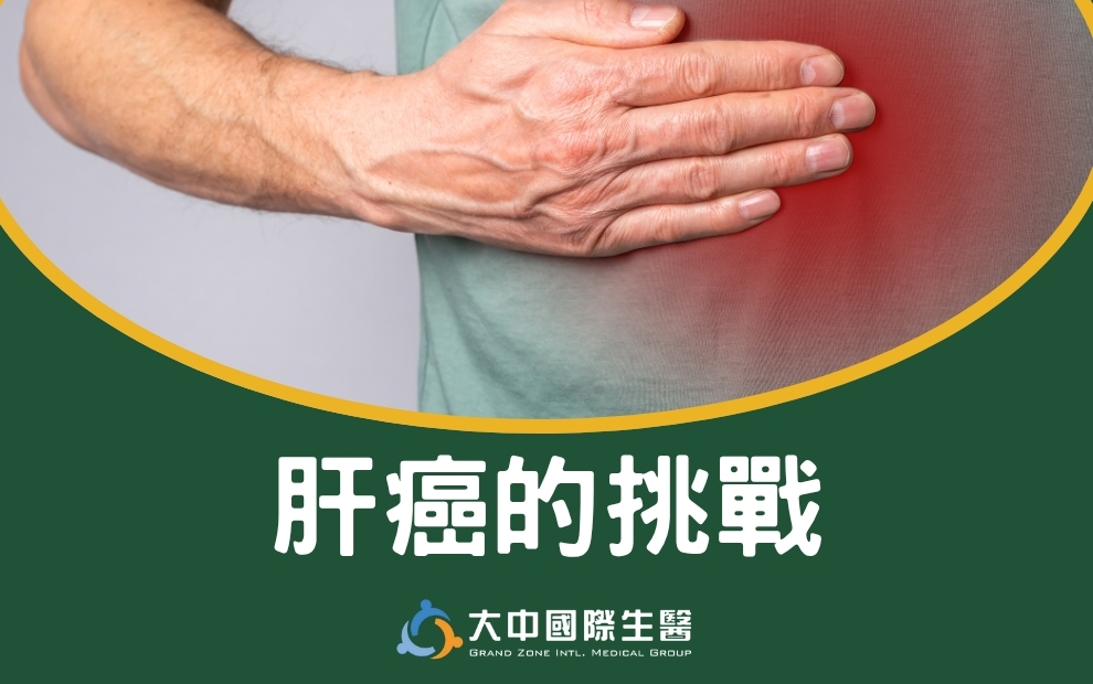 肝癌的挑戰:如何選擇適合的治療方案