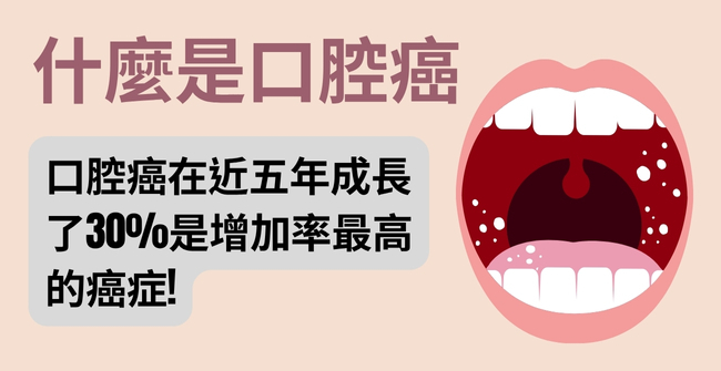 嘴破久久不癒？認識口腔癌如何自我檢查＆治療解析！
