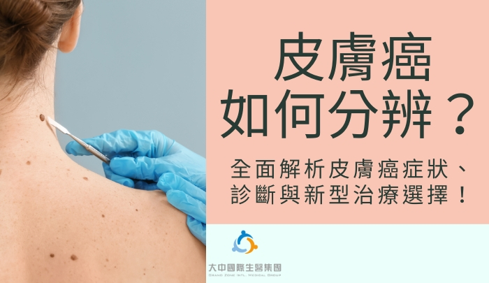 皮膚癌如何分辨？全面解析皮膚癌症狀、診斷與新型治療選擇！